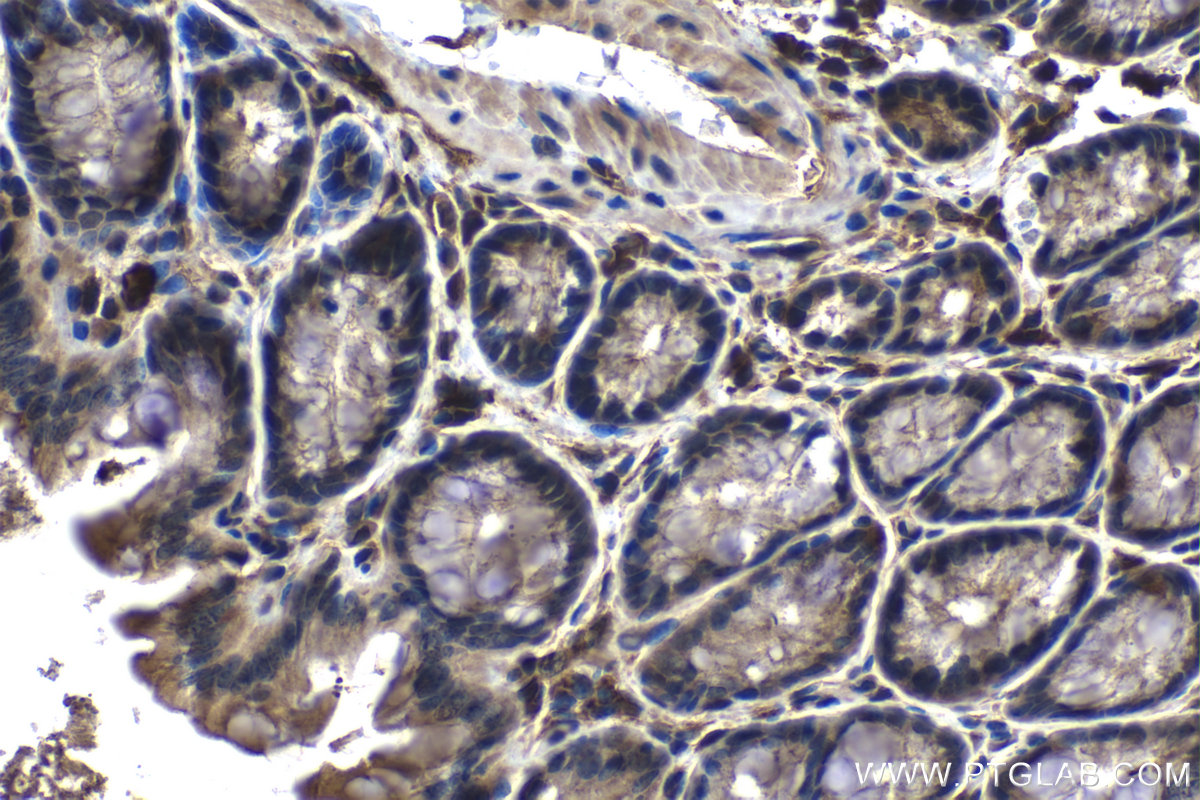 IHC staining of mouse colon using 68171-1-Ig (same clone as 68171-1-PBS)