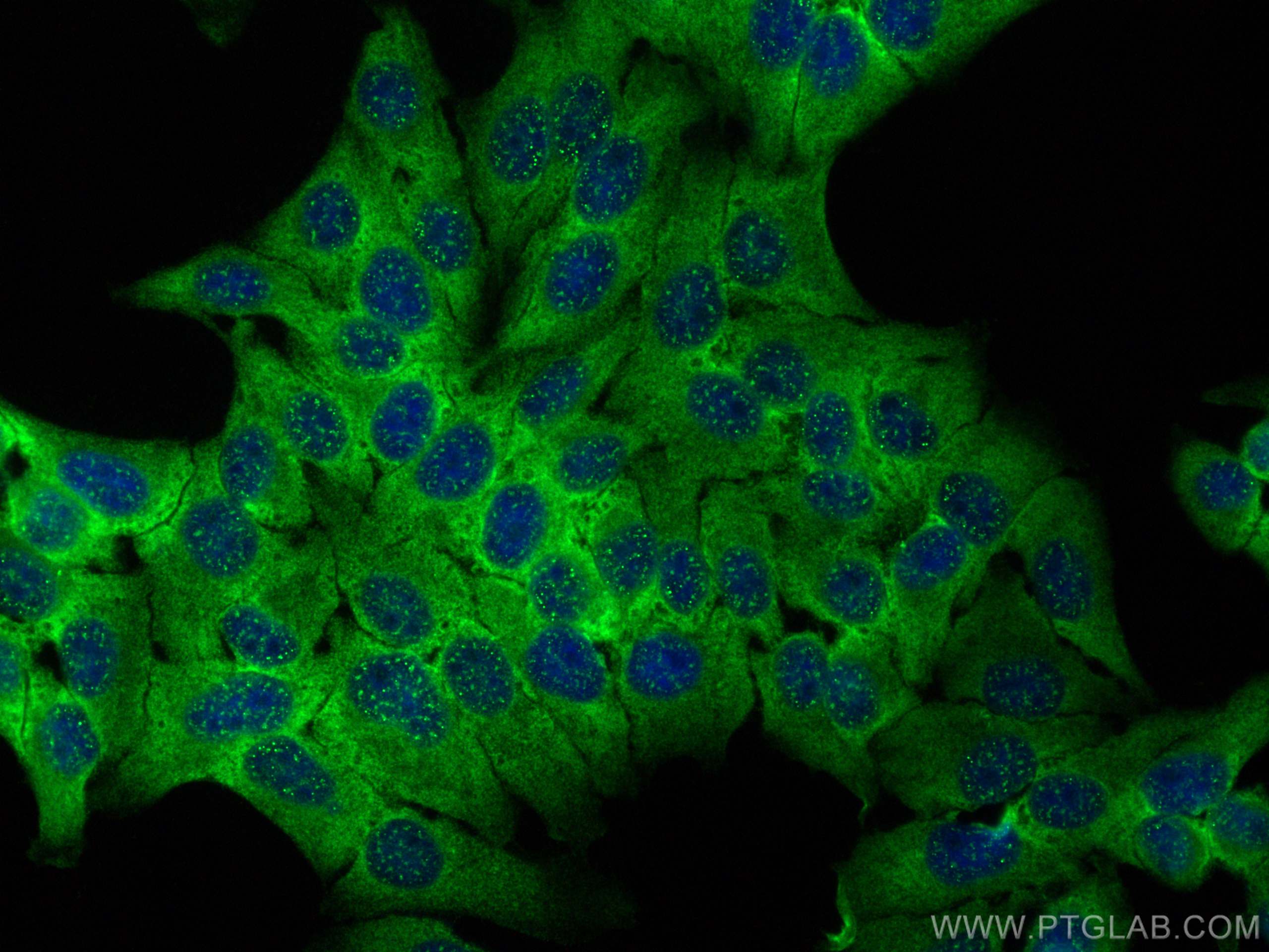 IF Staining of HepG2 using 15704-1-AP