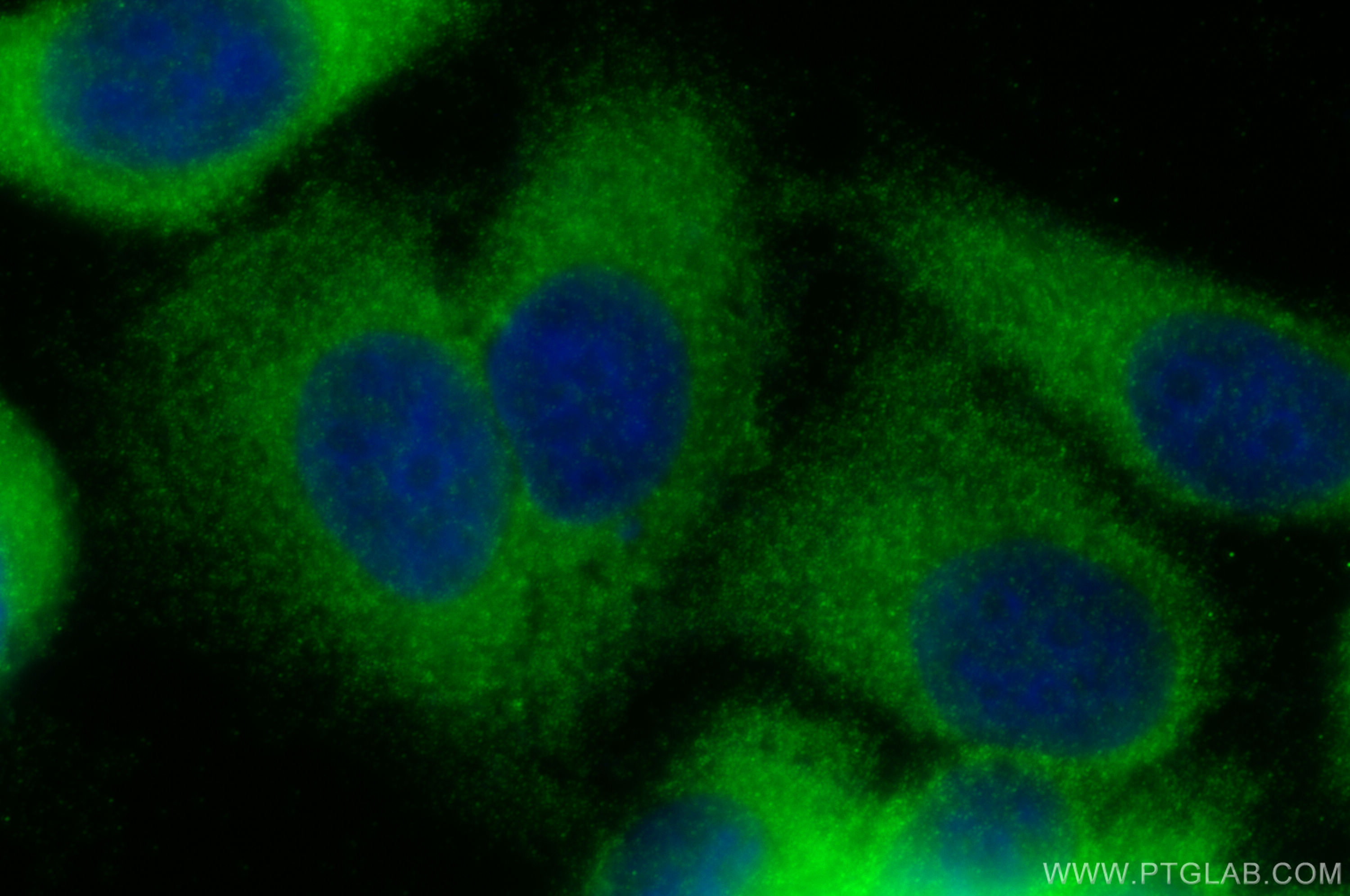 IF Staining of HepG2 using 17728-1-AP