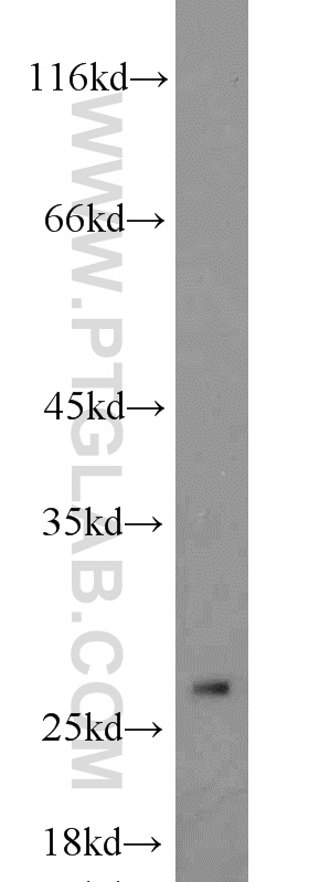 WB analysis of HeLa using 11012-1-AP