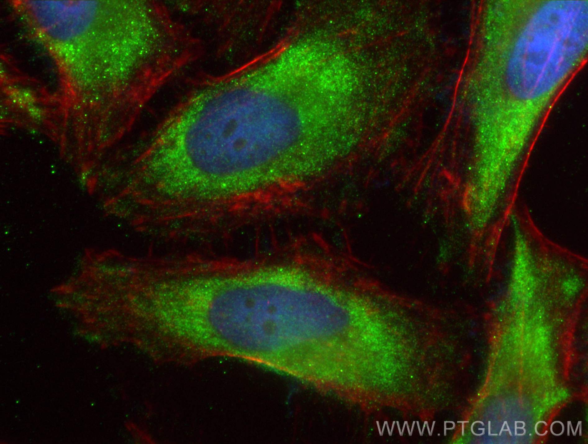 IF Staining of HeLa using 11309-1-AP