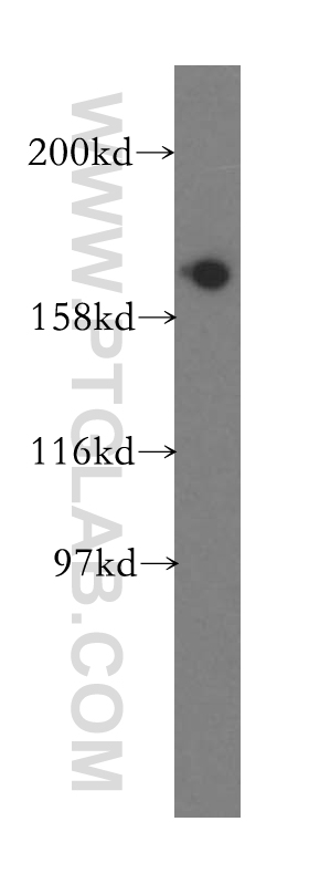 WB analysis of mouse brain using 13527-1-AP