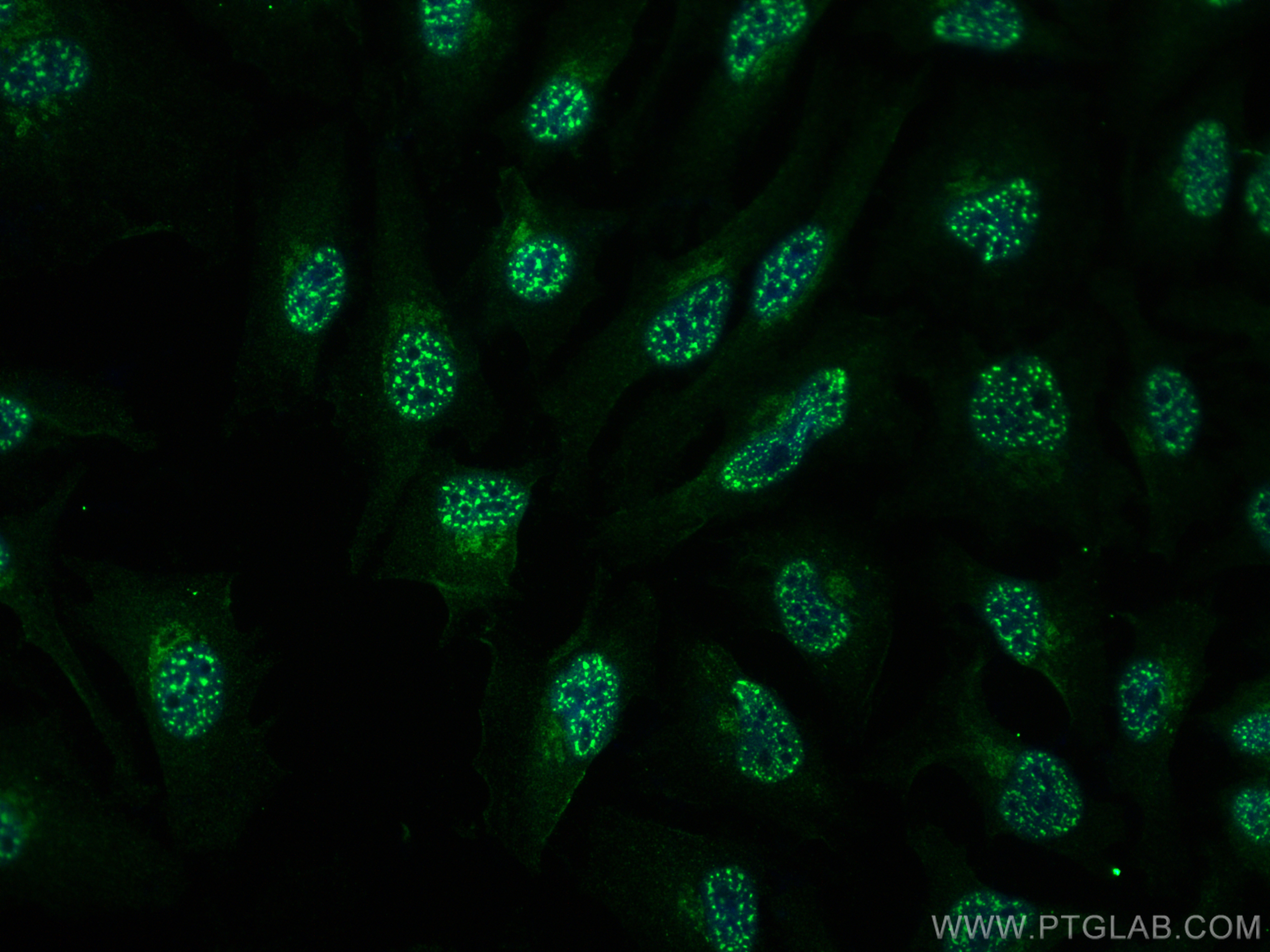 IF Staining of HeLa using 68765-3-Ig