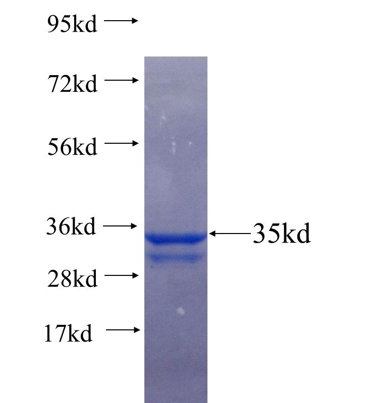 ELMO1 fusion protein Ag25635 SDS-PAGE