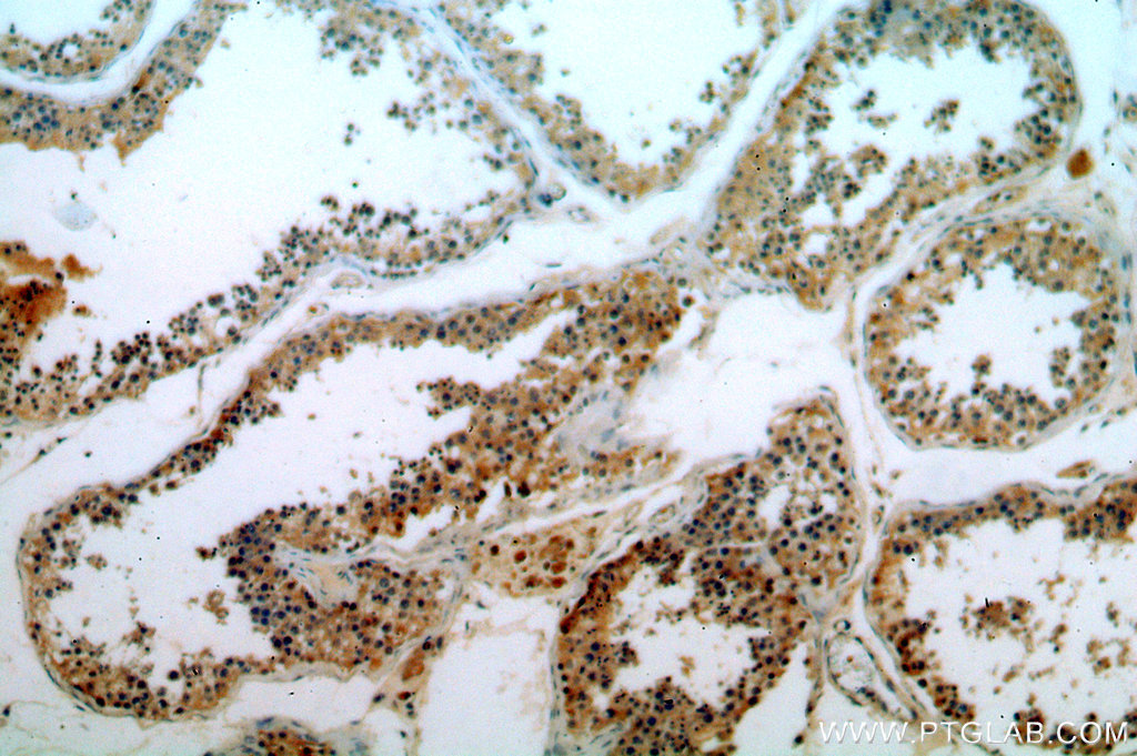 IHC staining of human testis using 20308-1-AP