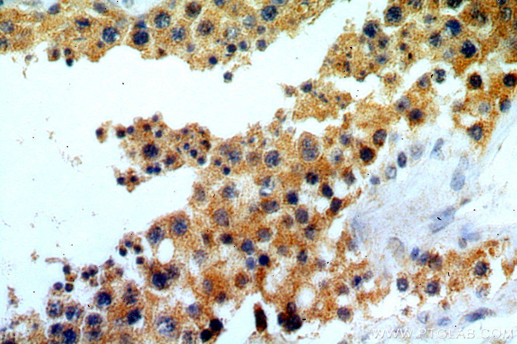 IHC staining of human testis using 20308-1-AP