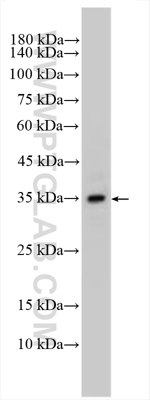 WB analysis using 55023-1-AP