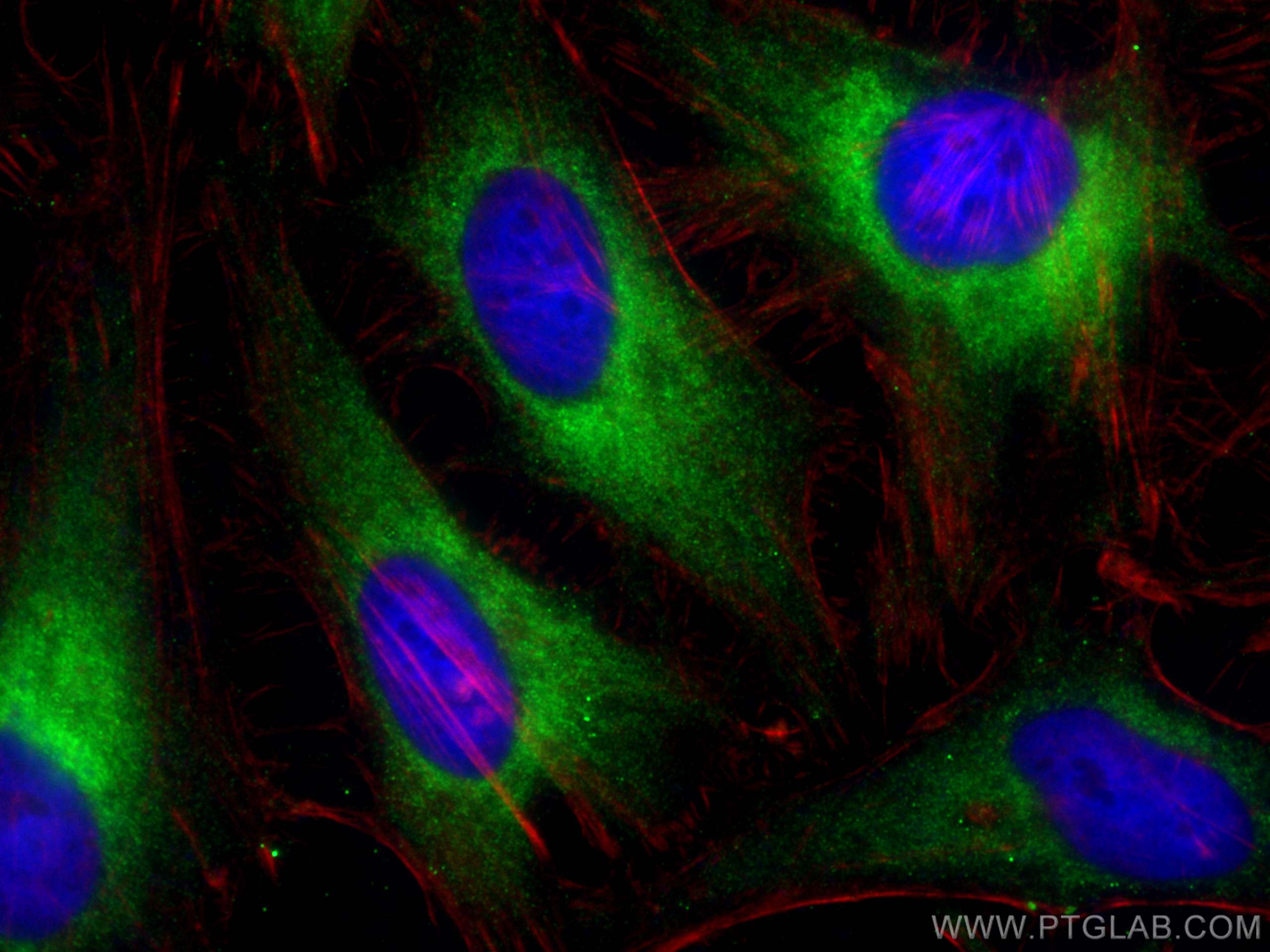 IF Staining of HeLa using 26599-1-AP