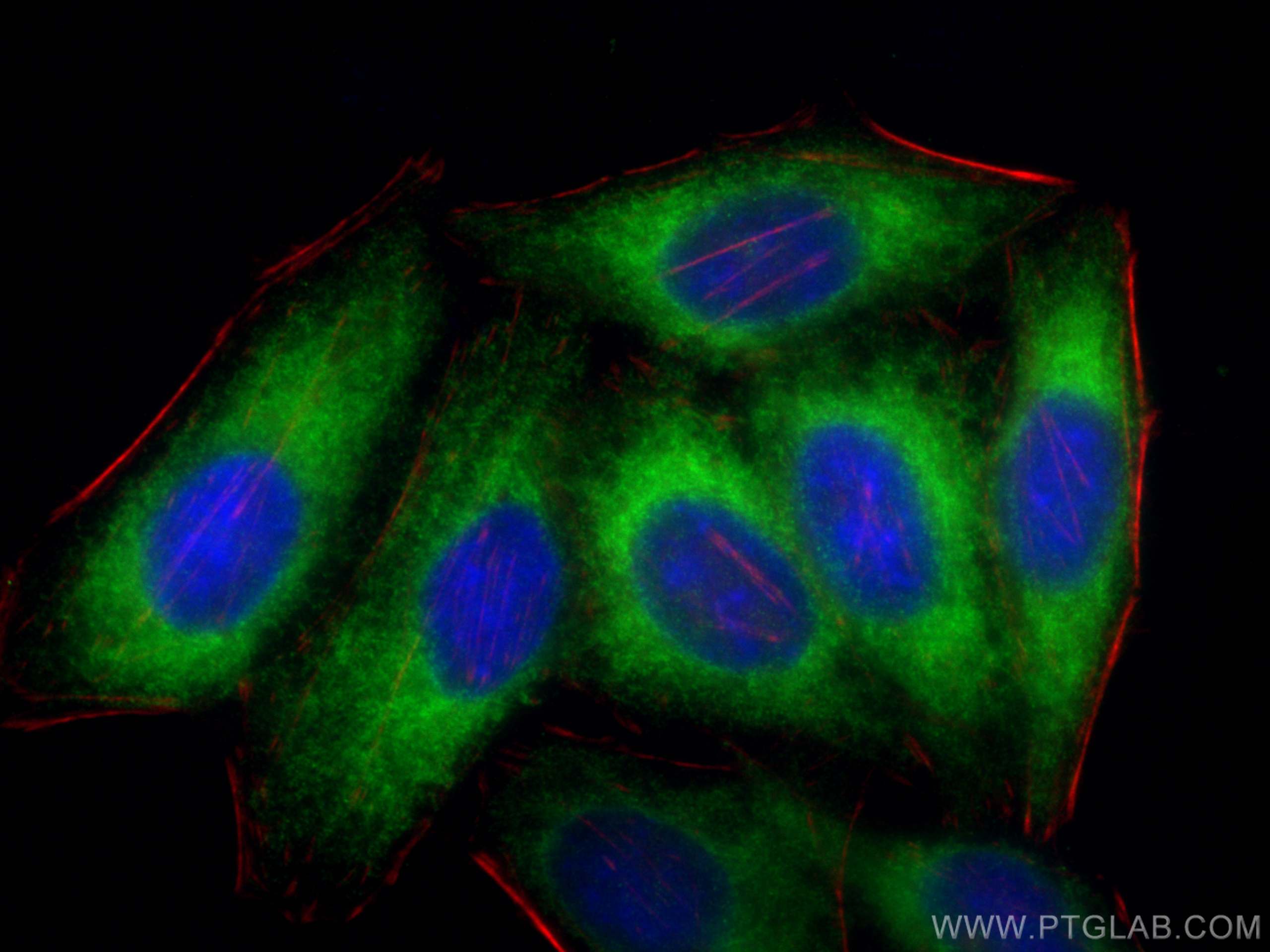 IF Staining of HepG2 using 26599-1-AP