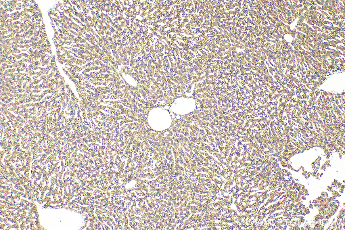 IHC staining of mouse liver using 26599-1-AP