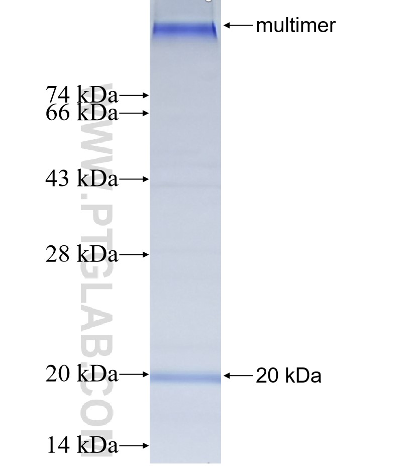 ELOVL7 fusion protein Ag25008 SDS-PAGE