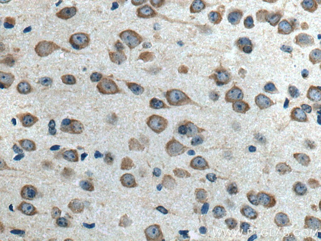 IHC staining of mouse brain using 17016-1-AP