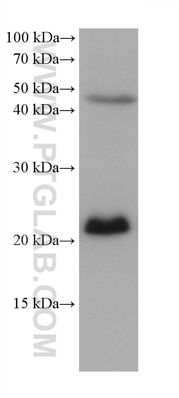 EMC7/C15orf24  (Human Specific) 