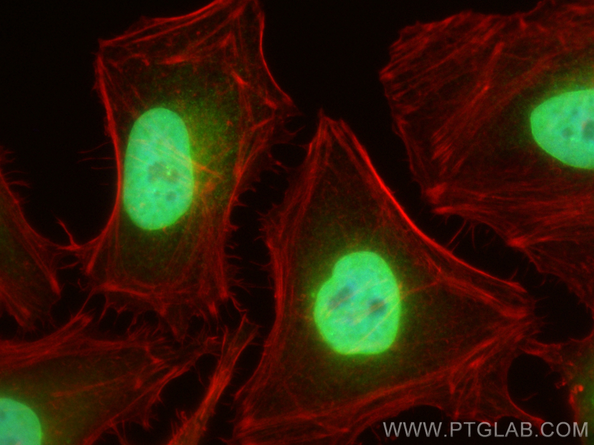 IF Staining of HeLa using 82888-2-RR (same clone as 82888-2-PBS)