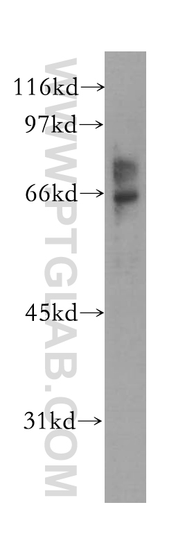 WB analysis of A375 using 12975-1-AP