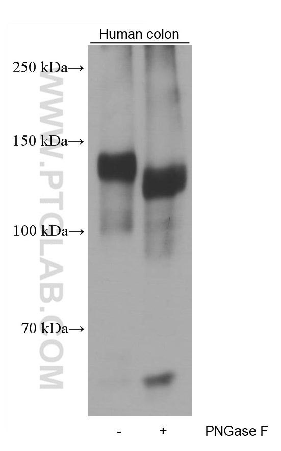 WB analysis of human colon using 60047-1-Ig (same clone as 60047-1-PBS)