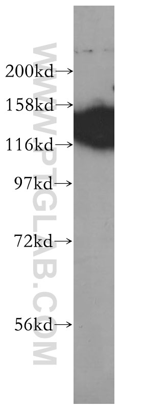 EMILIN1 Monoclonal antibody