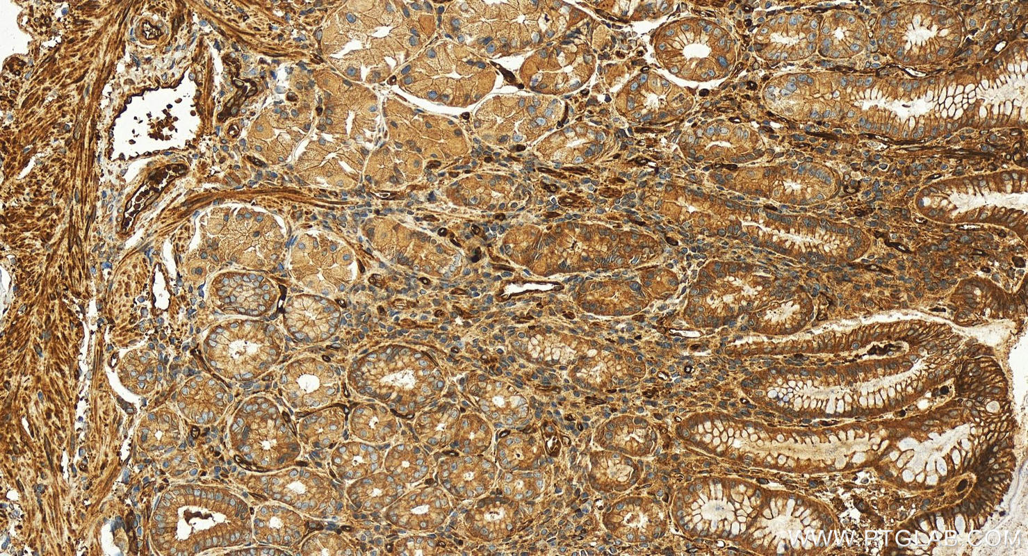 IHC staining of human stomach using 12765-1-AP