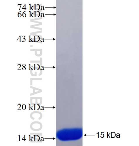 EML2 fusion protein Ag25984 SDS-PAGE