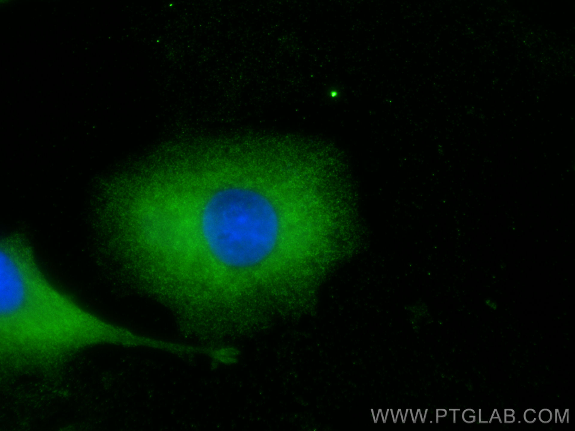 IF Staining of A549 using 22709-1-AP