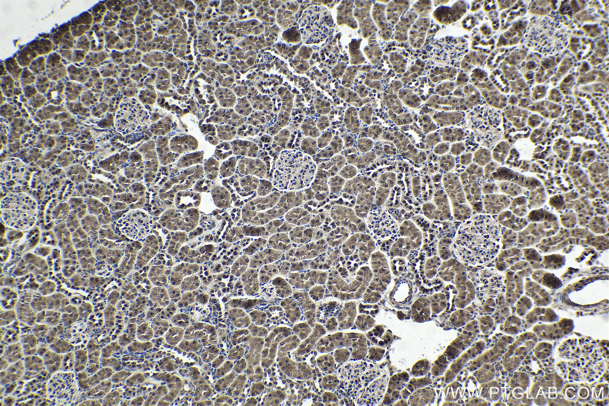 IHC staining of rat kidney using 55032-1-AP