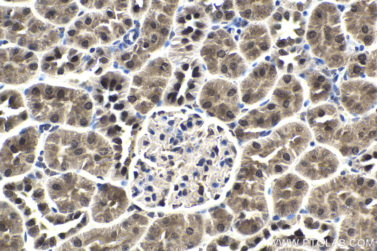 IHC staining of rat kidney using 55032-1-AP