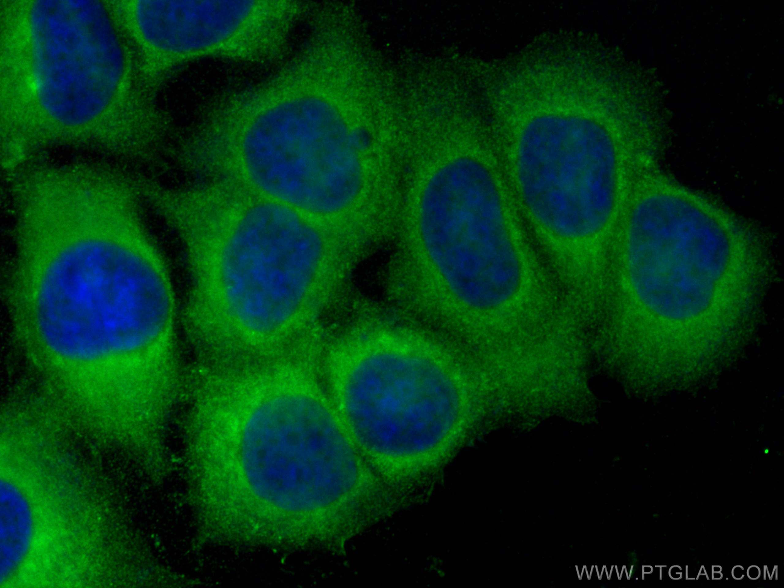 IF Staining of MCF-7 using 26421-1-AP