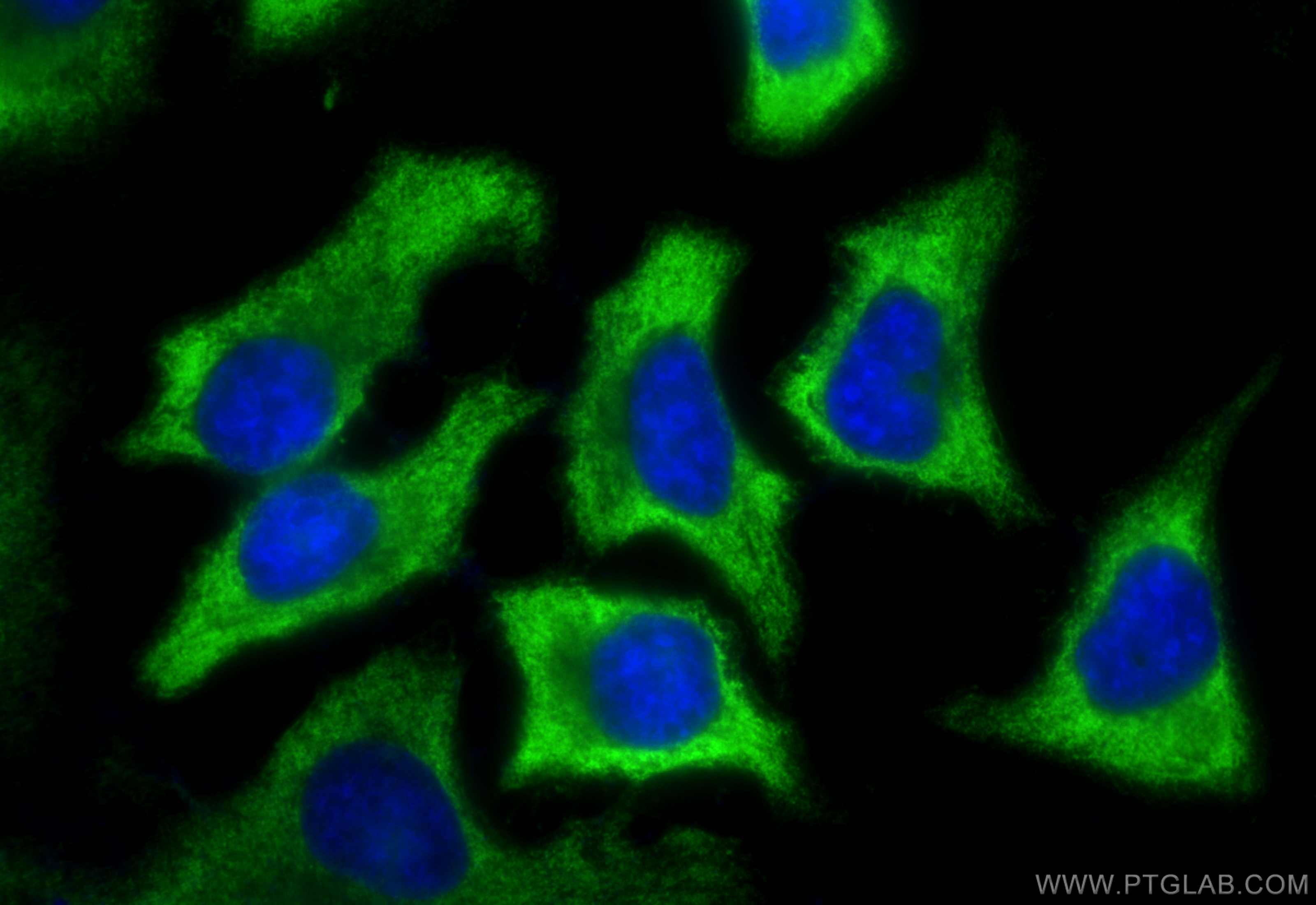 IF Staining of HeLa using 67187-1-Ig