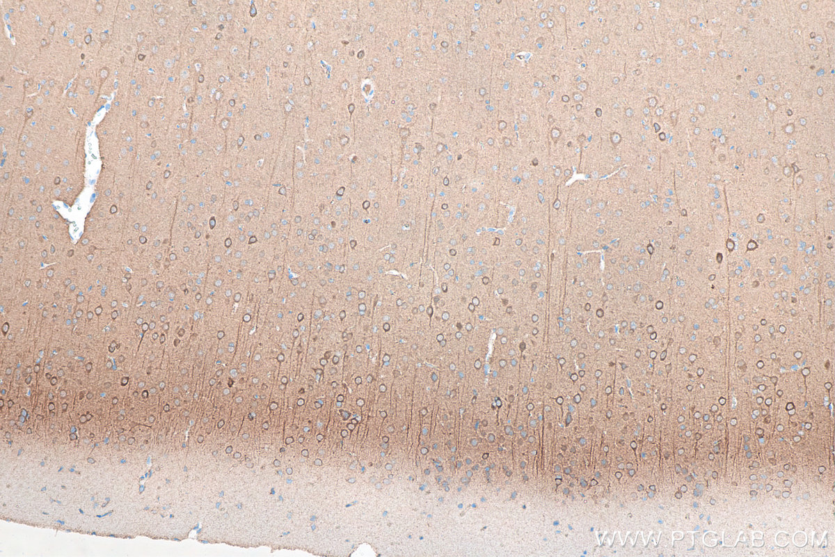 IHC staining of rat brain using 66150-1-Ig (same clone as 66150-1-PBS)