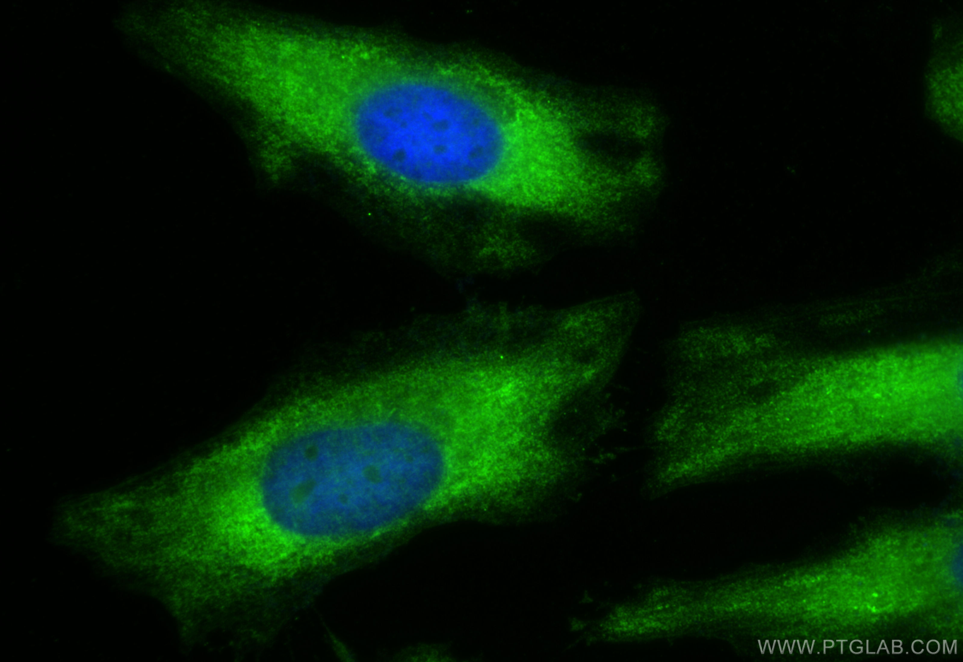 IF Staining of HeLa using 16421-1-AP