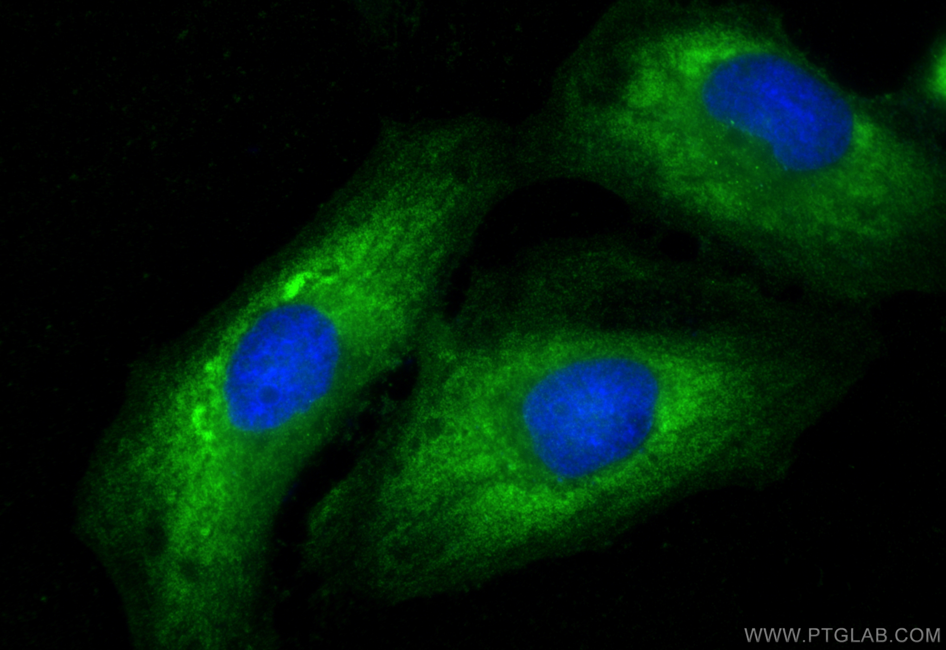 IF Staining of HeLa using 55234-1-AP