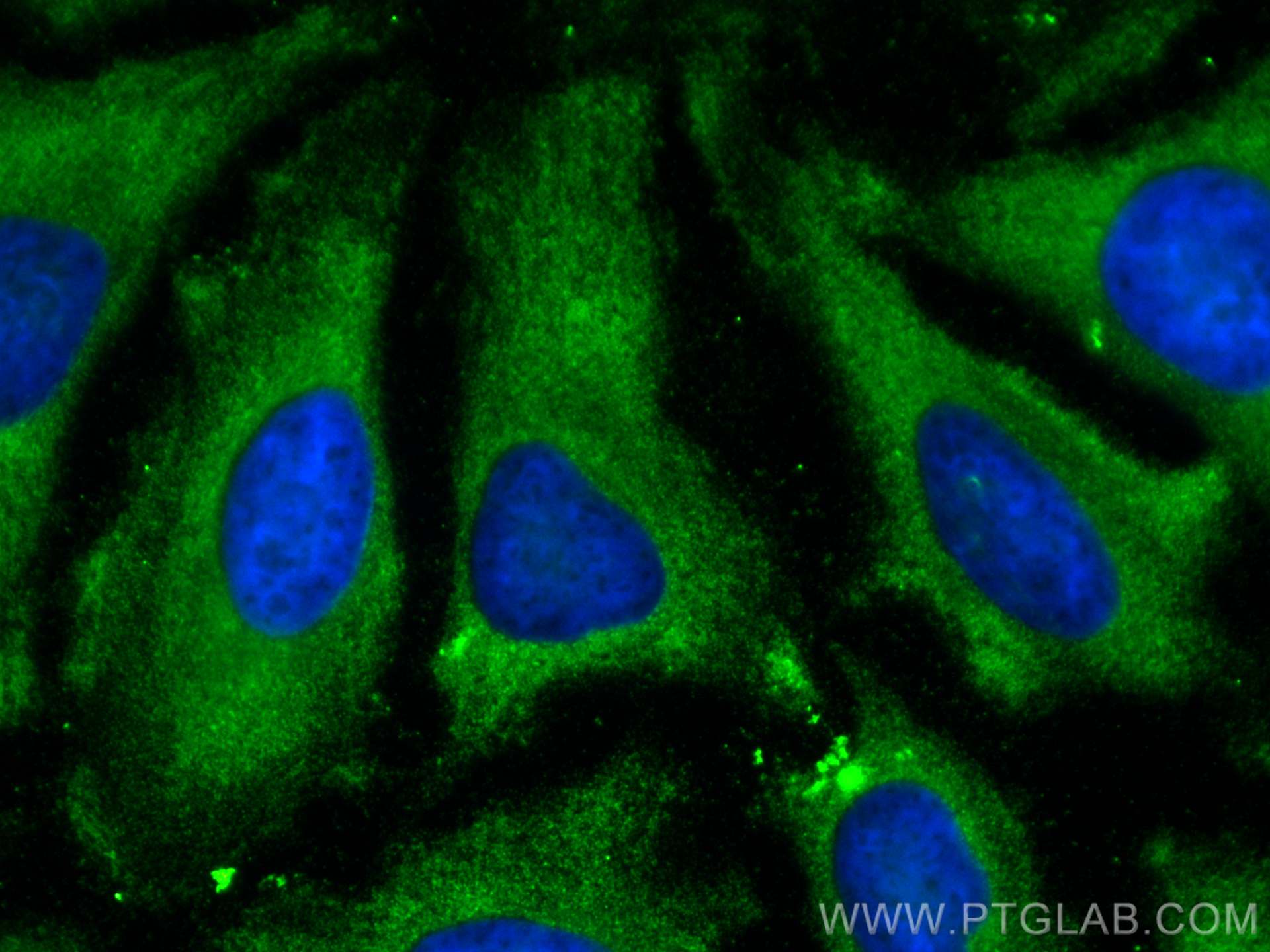 IF Staining of HeLa using 68147-1-Ig