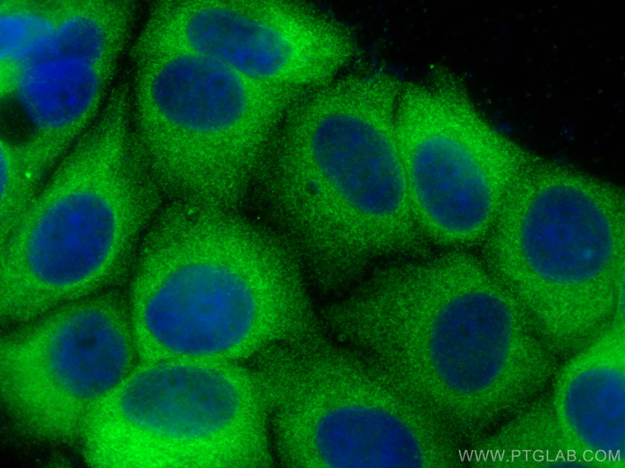 IF Staining of MCF-7 using 10423-1-AP