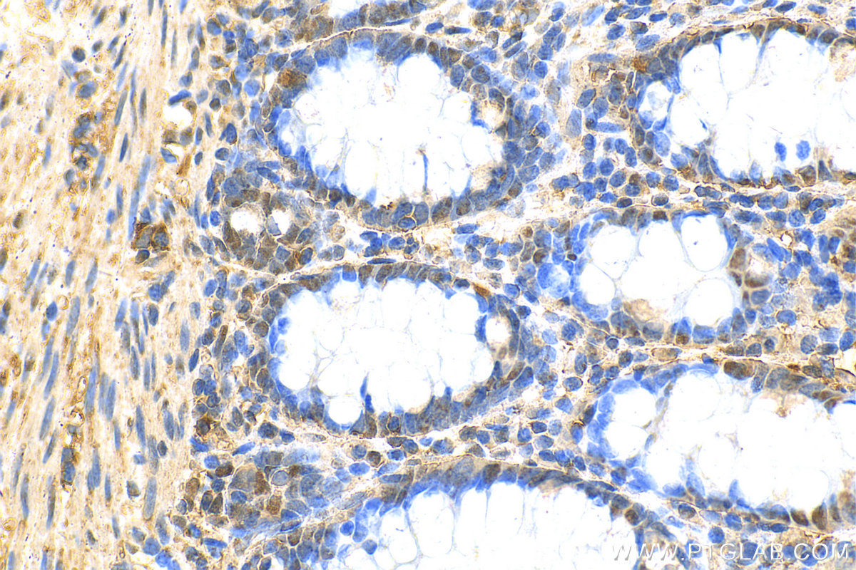 IHC staining of human colon using 14518-1-AP