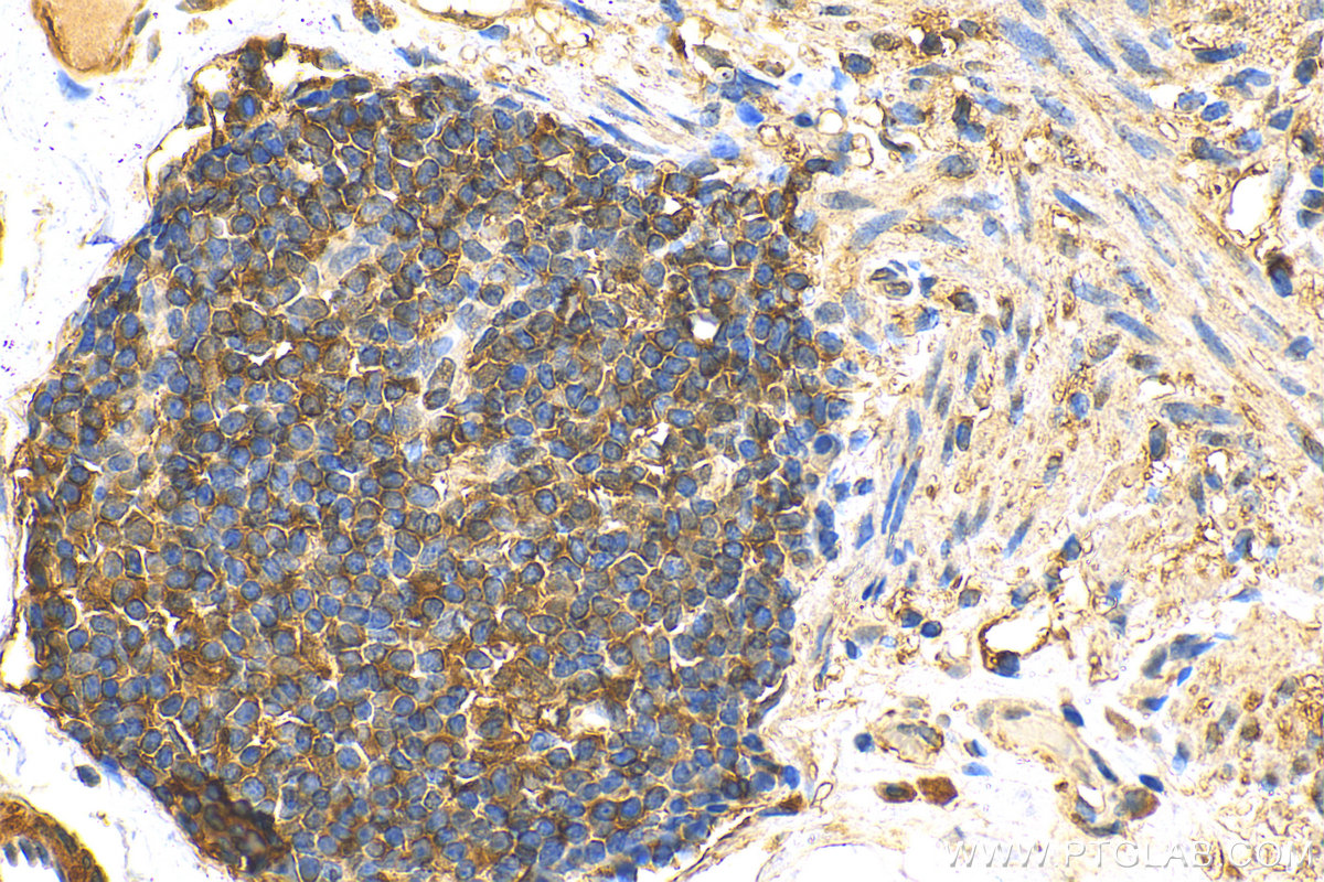 IHC staining of human colon using 14518-1-AP