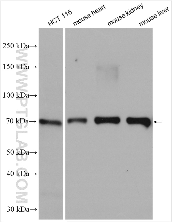 WB analysis using 29862-1-AP