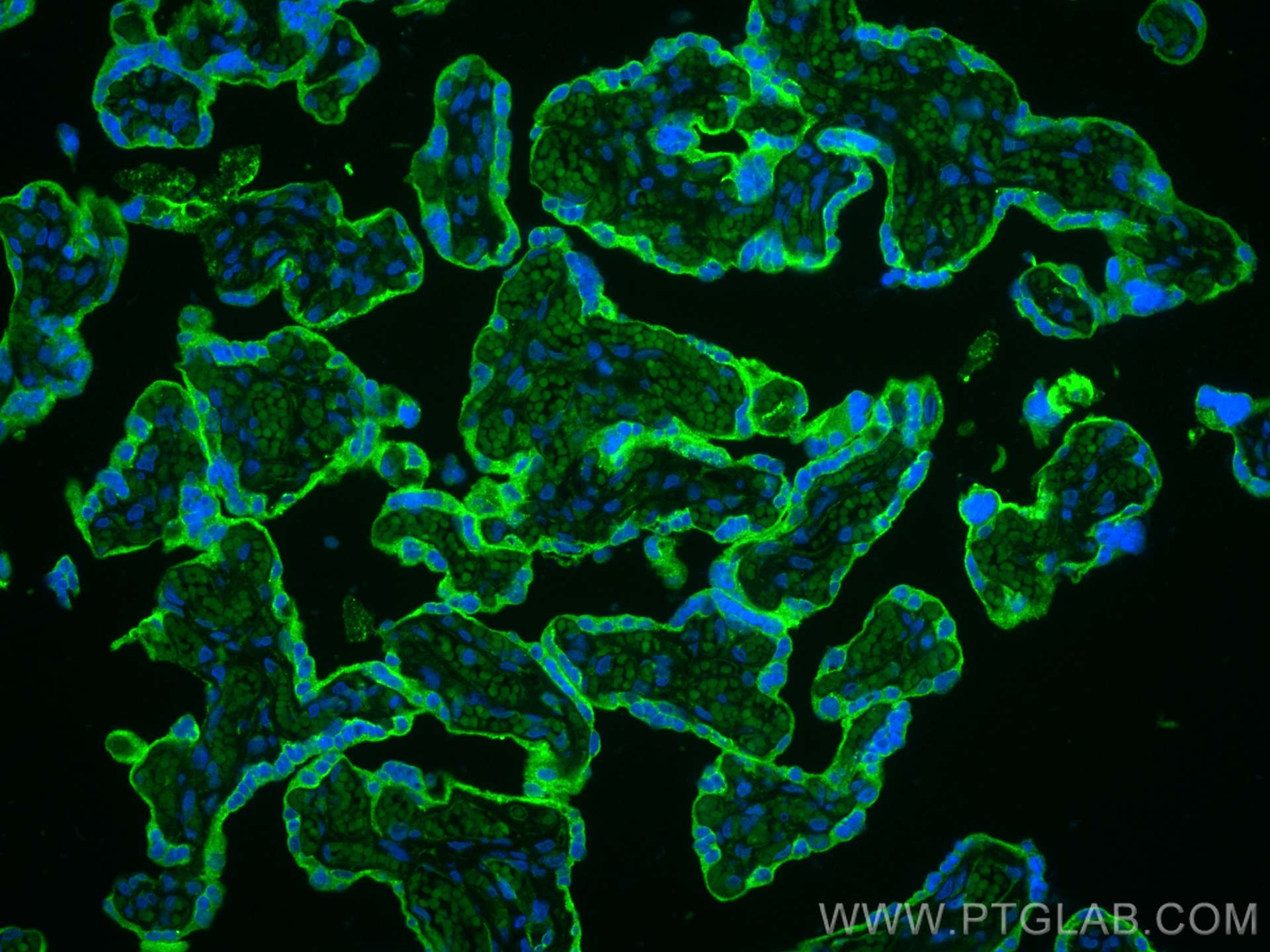 IF Staining of human placenta using 14211-1-AP