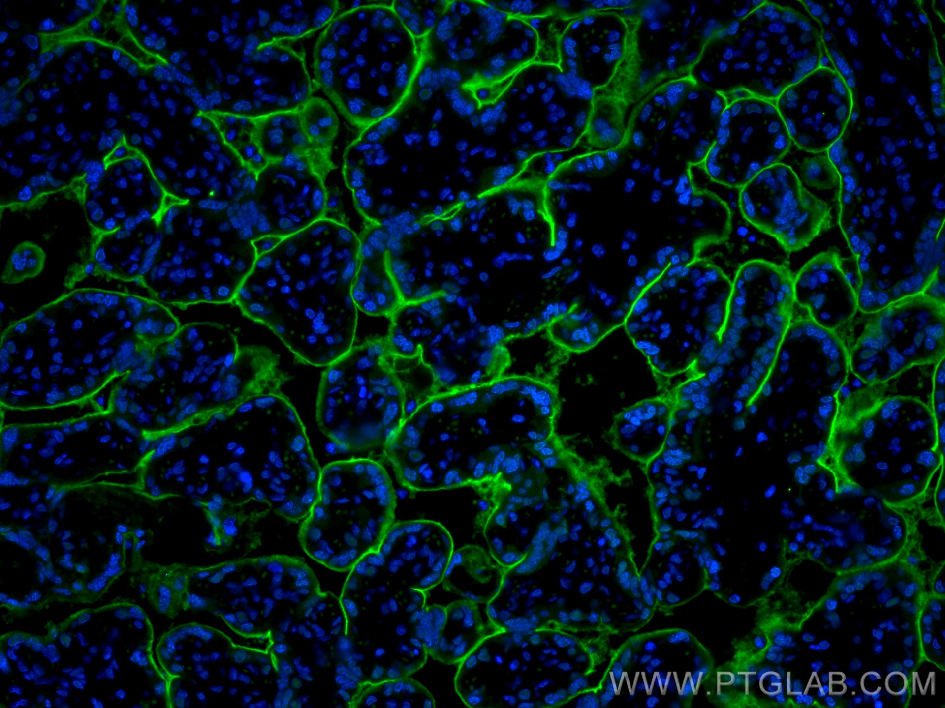 IF Staining of human placenta using 19229-1-AP