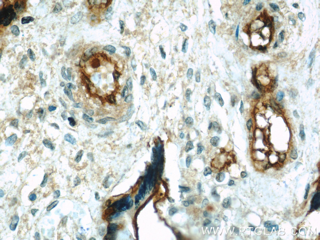 IHC staining of human placenta using 19229-1-AP