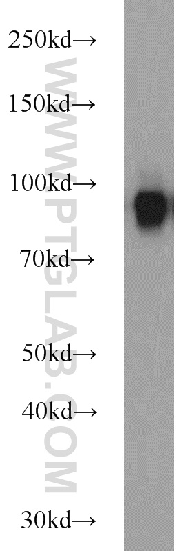 WB analysis of mouse liver using 19229-1-AP