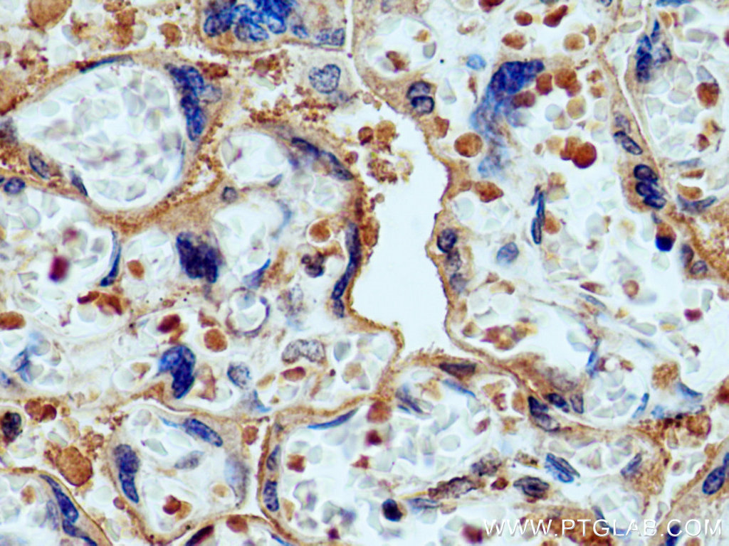 IHC staining of human placenta using 60323-1-Ig (same clone as 60323-1-PBS)