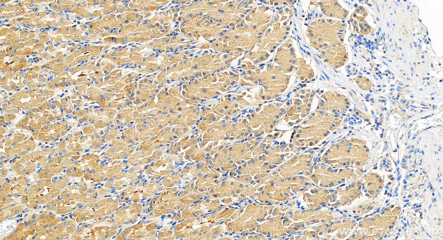 IHC staining of human normal stomach using 18848-1-AP