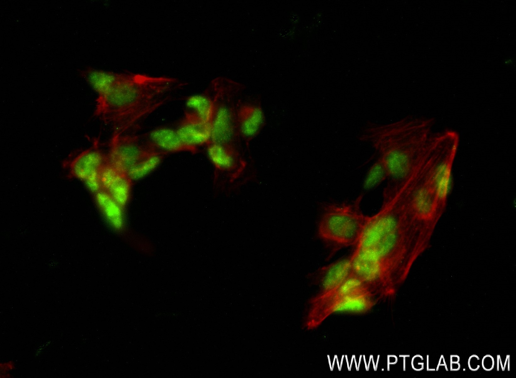 IF Staining of SH-SY5Y using 83945-5-RR