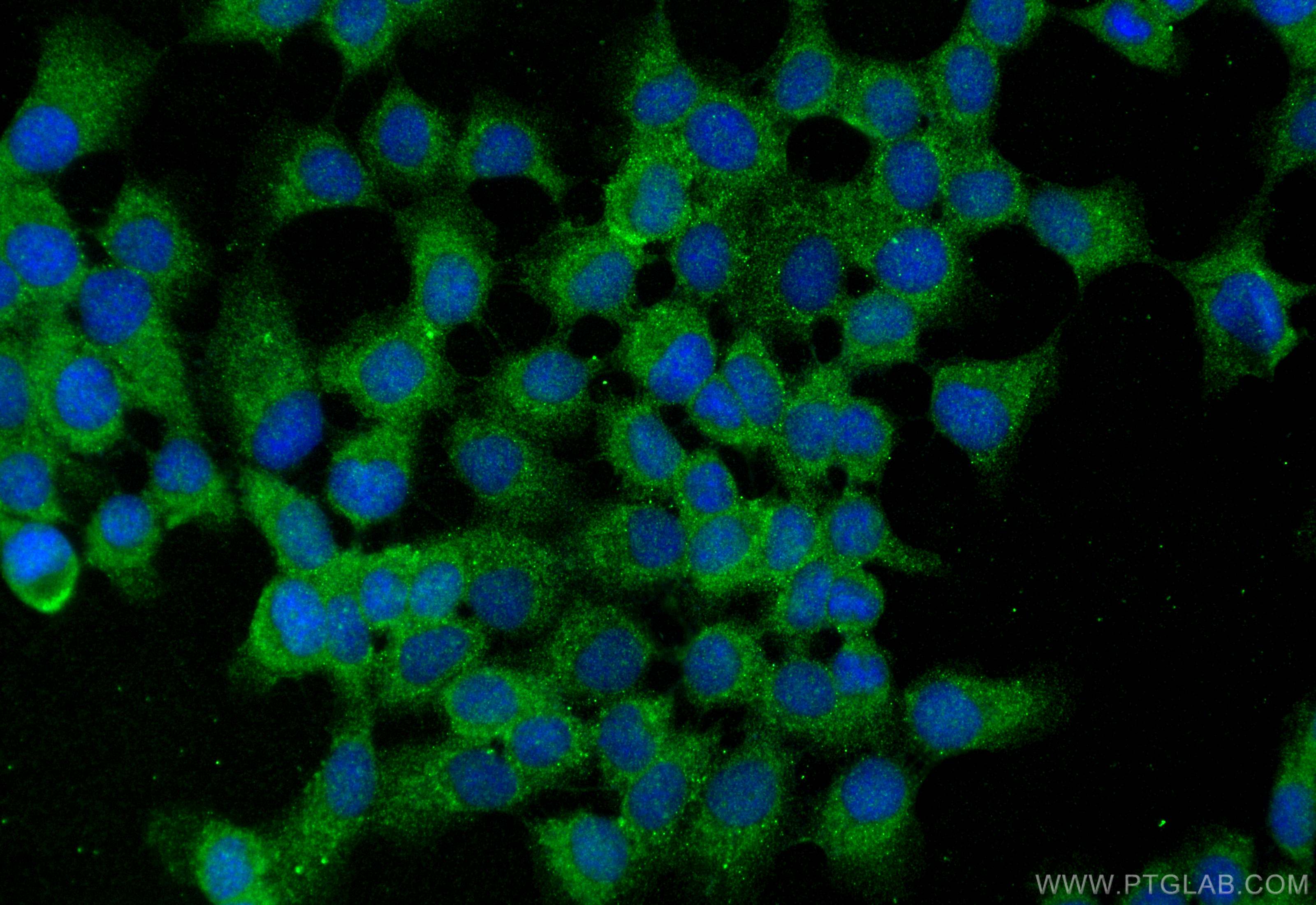 IF Staining of A431 using 15437-1-AP