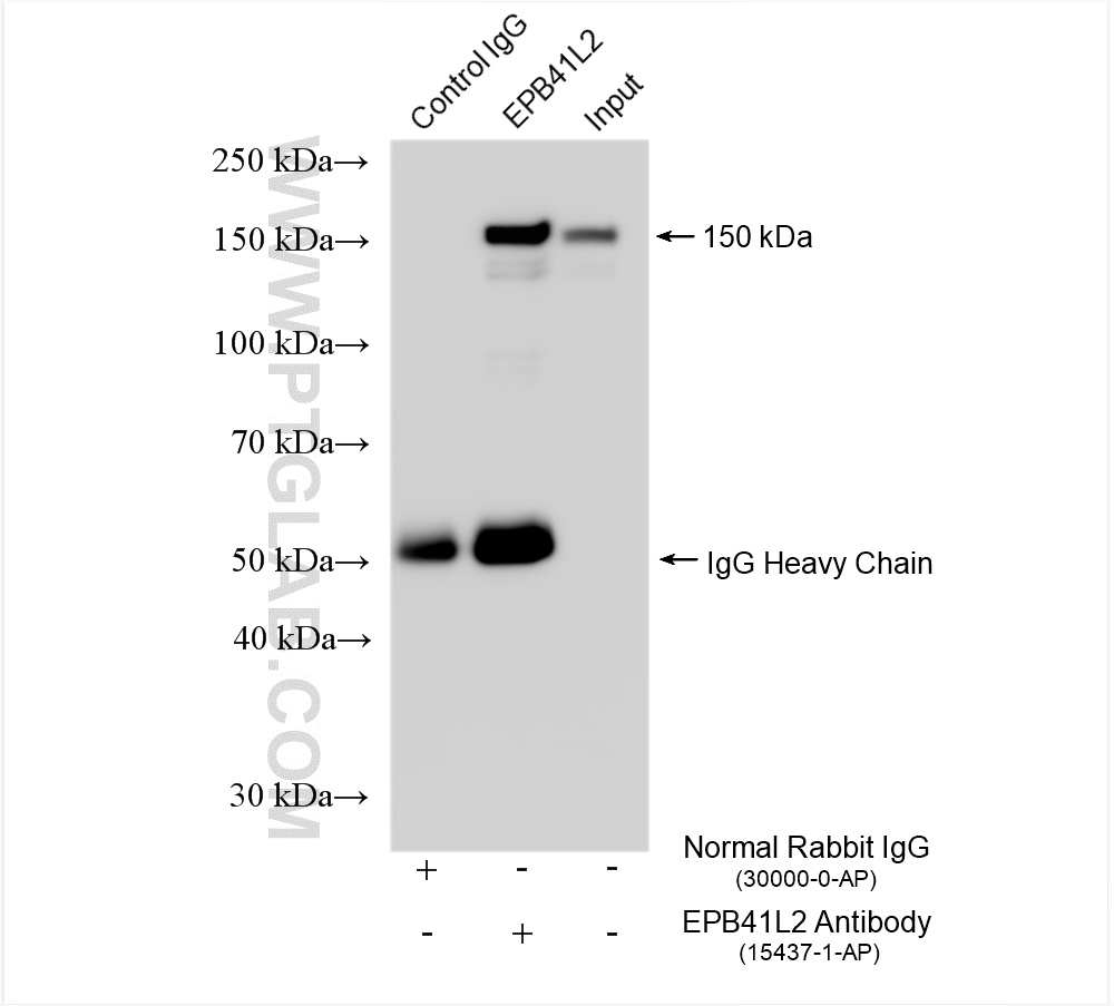 IP experiment of HEK-293 using 15437-1-AP