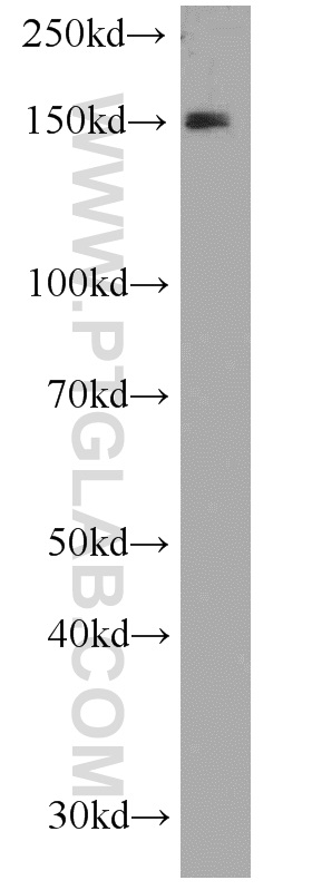 WB analysis of HeLa using 15437-1-AP