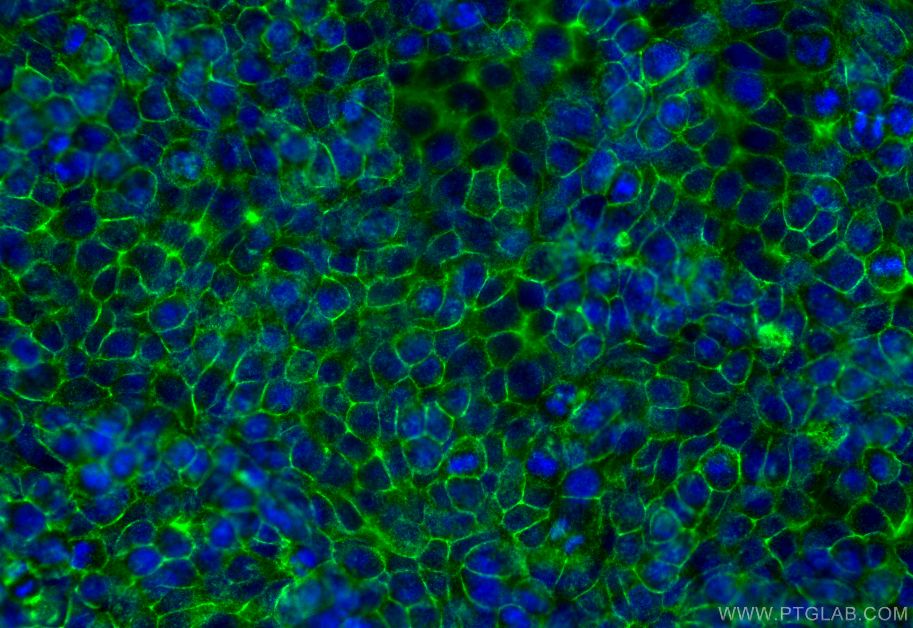 IF Staining of HT-29 using 21050-1-AP