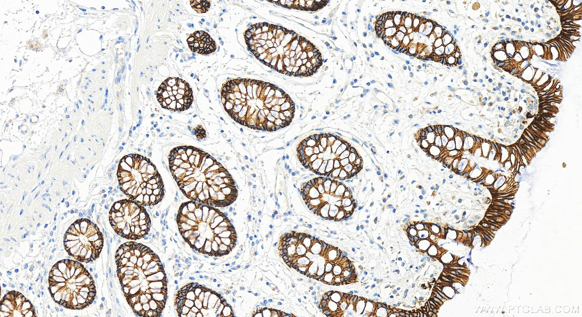 IHC staining of Human colon using 66316-1-Ig