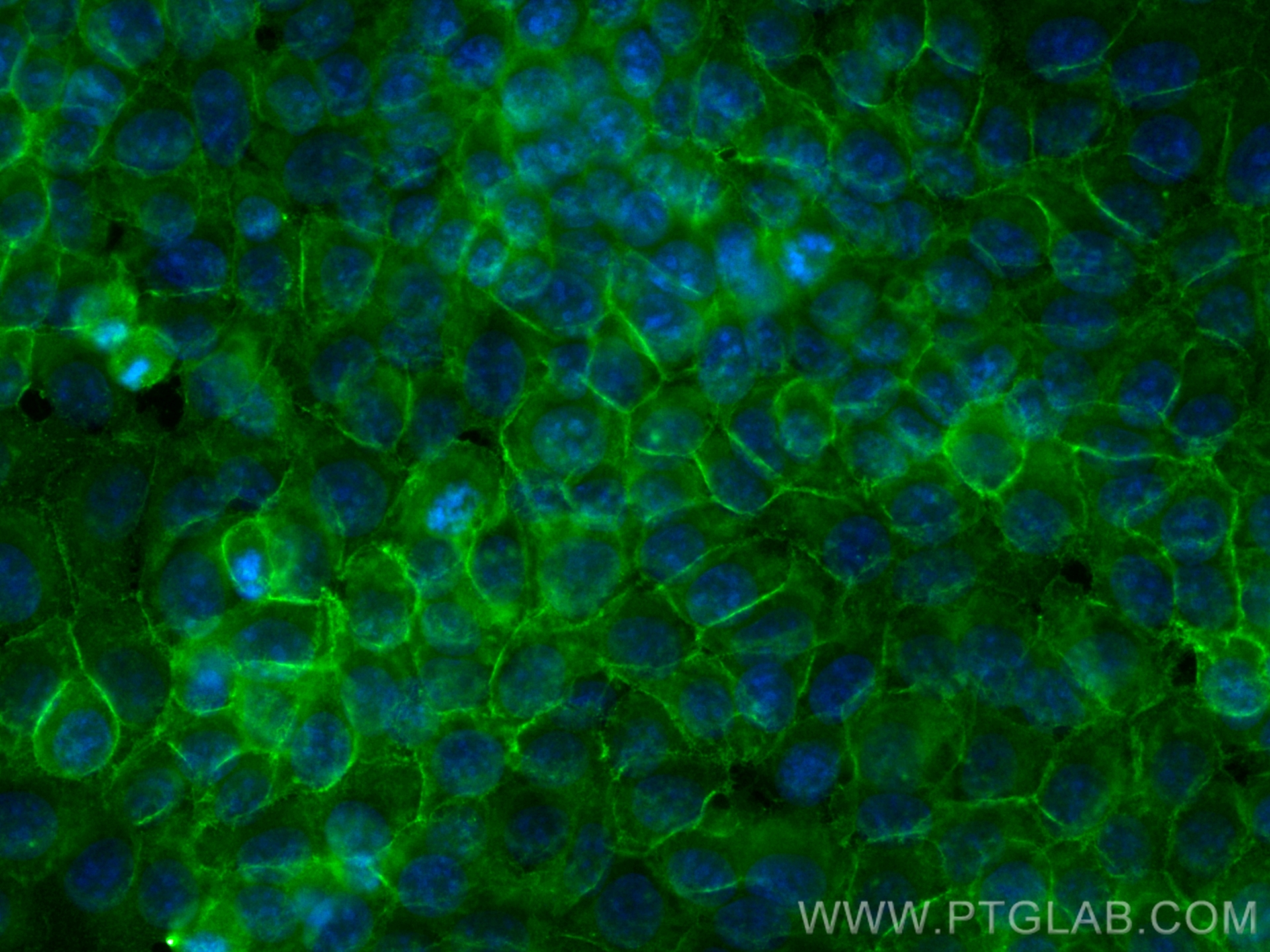 IF Staining of MCF-7 using CL488-21050