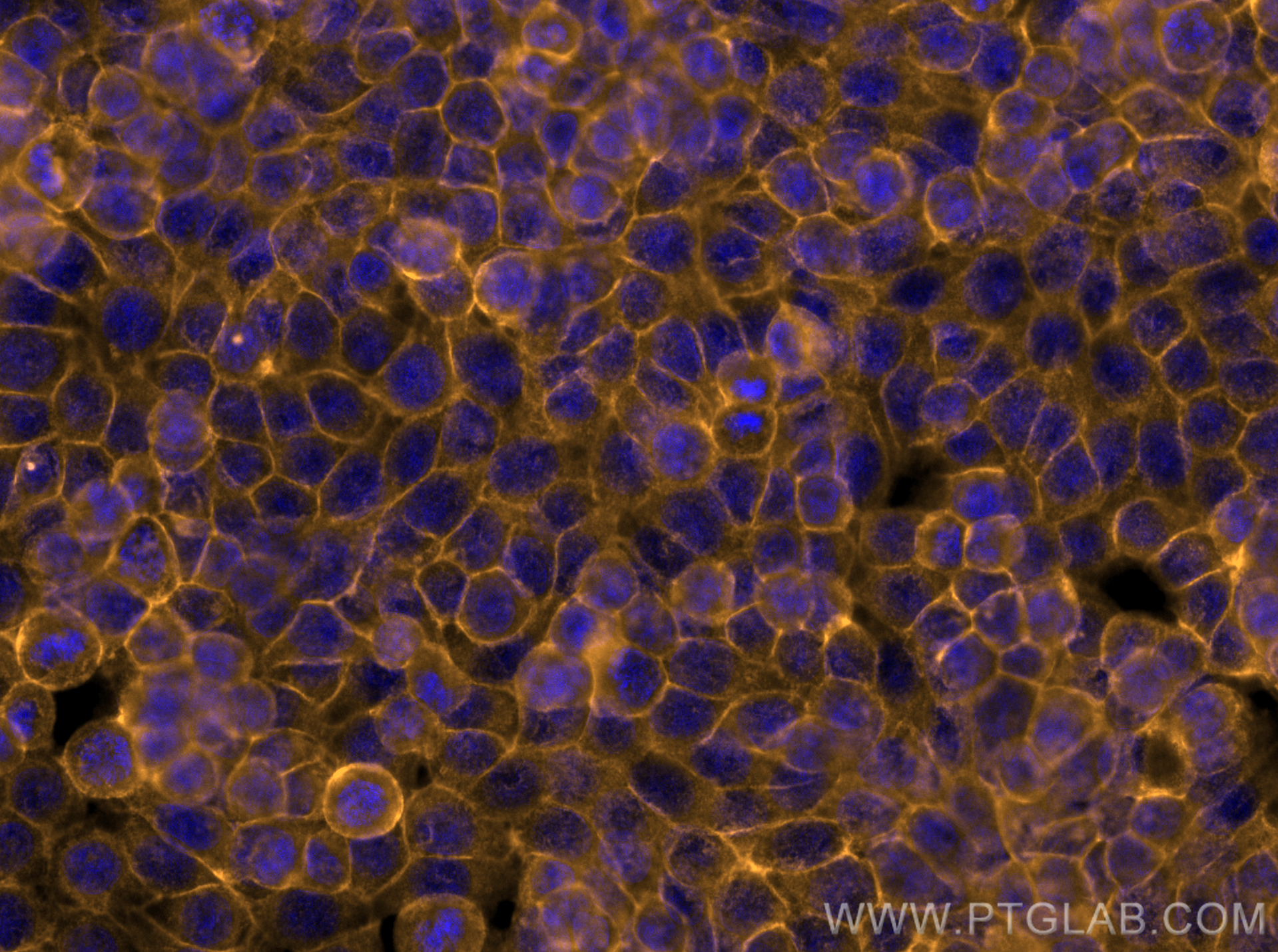 IF Staining of HT-29 using CL555-21050